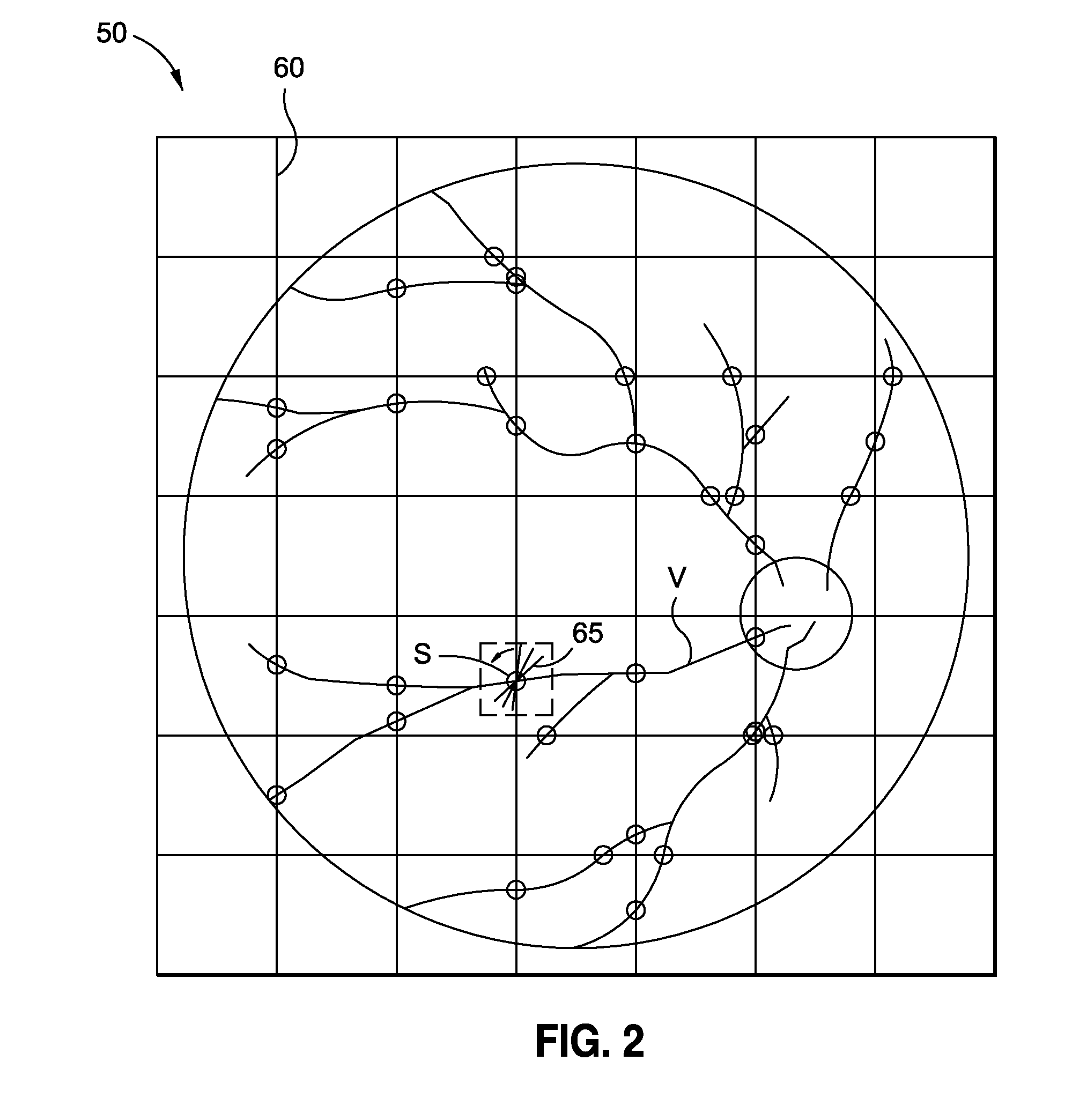 Fundus information processing apparatus and fundus information processing method