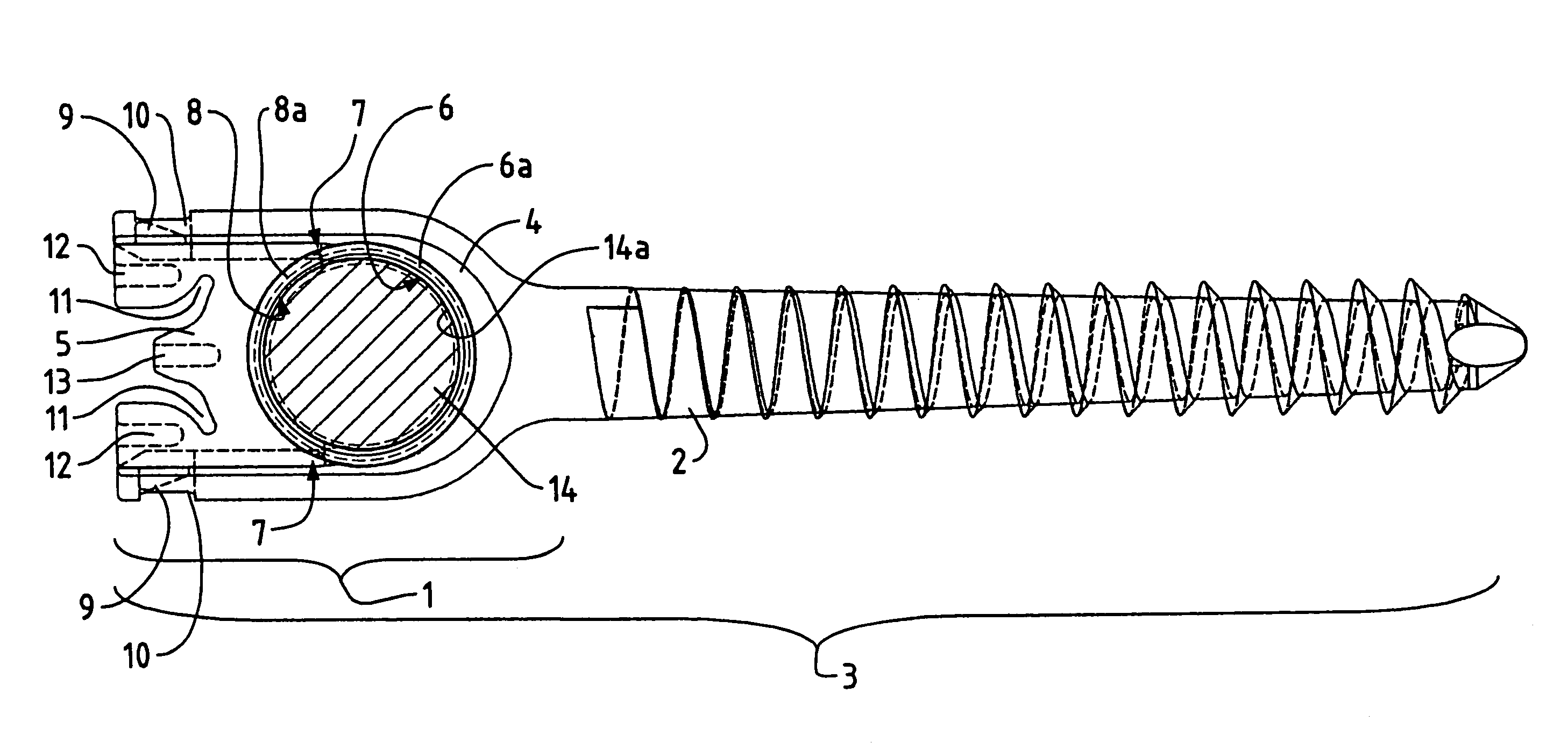 Pedicle screw with a closure device for the fixing of elastic rod elements