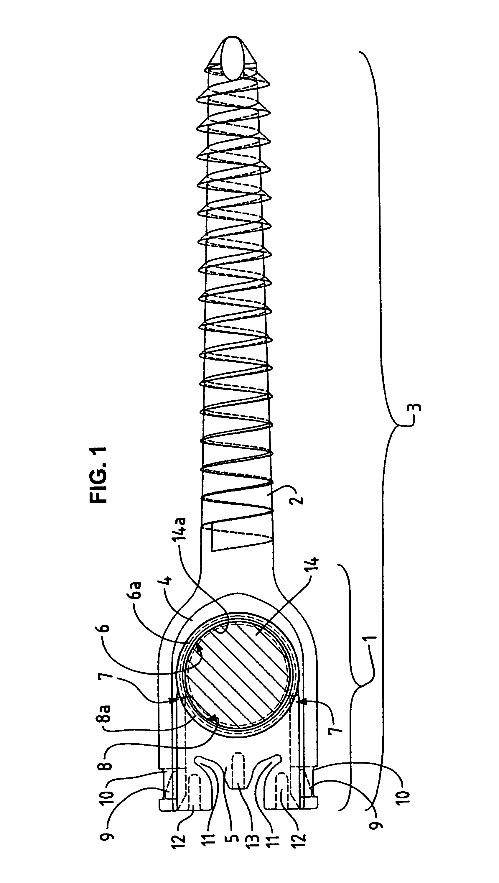 Pedicle screw with a closure device for the fixing of elastic rod elements