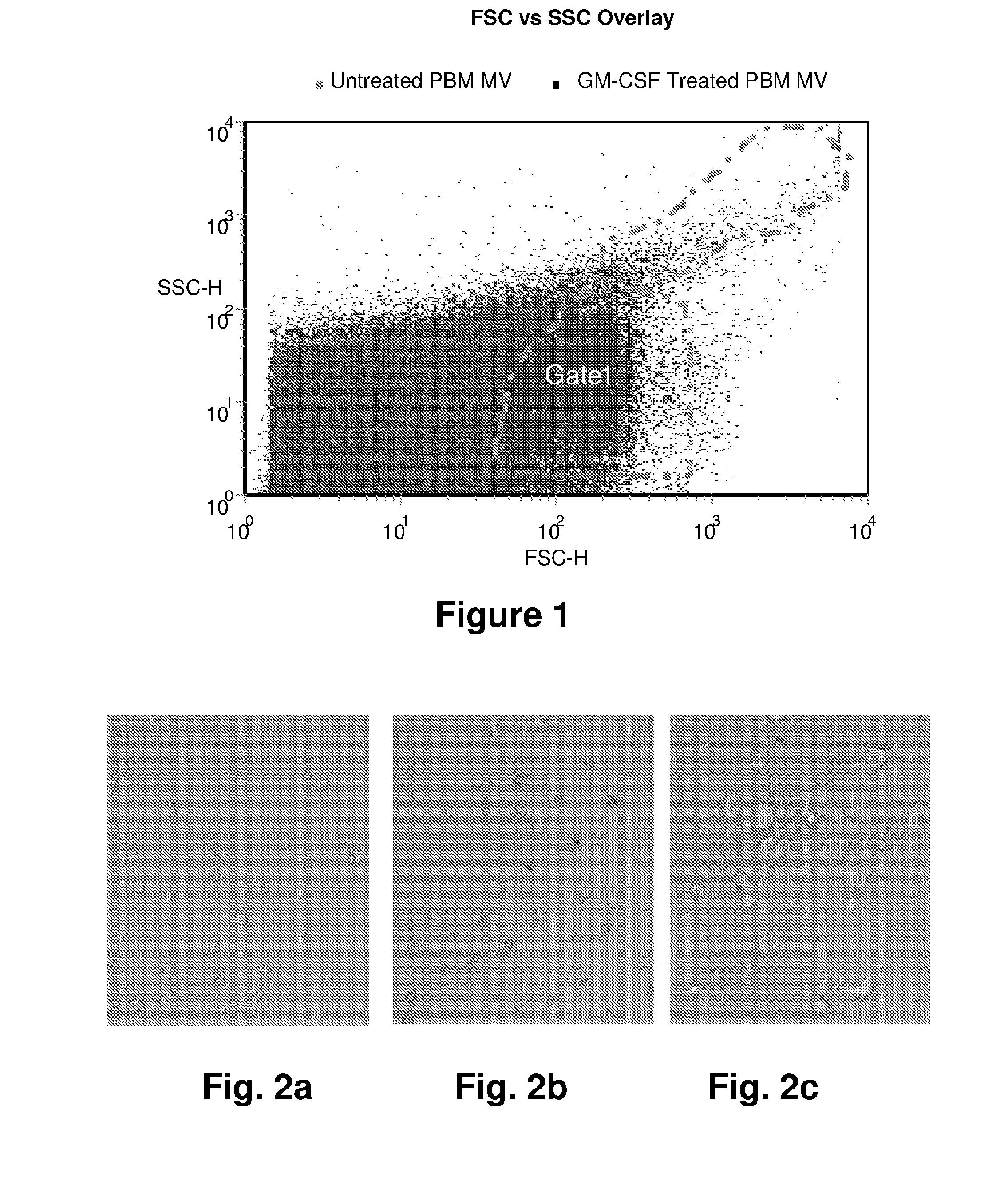 MicroRNA Expression in Human Peripheral Blood Microvesicles and Uses Thereof