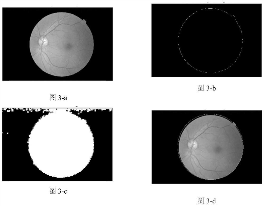 Fundus Retina Image Classification Method Based on Capsule Network
