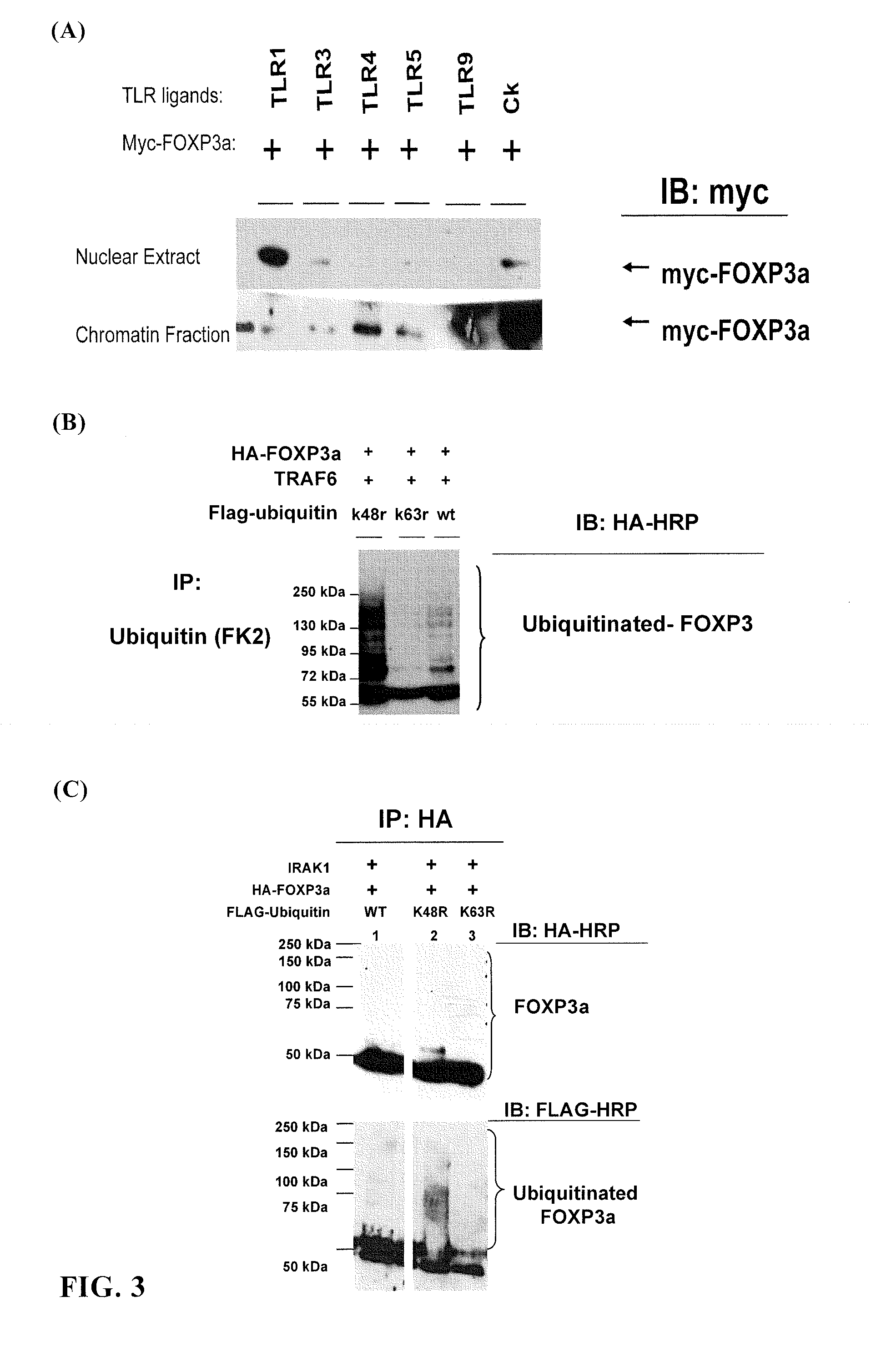 Regulatory factor of foxp3 and regulatory t cells and use thereof