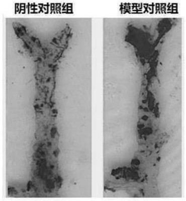 A kind of traditional Chinese medicine composition and its preparation method and application