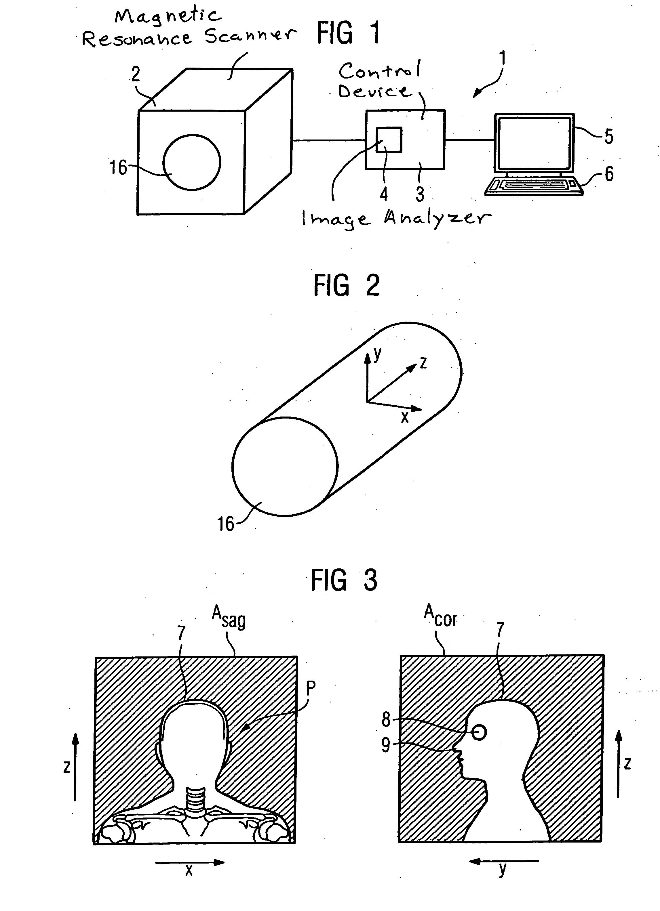 Method for determination of the supported position of a patient in a magnetic resonance apparatus