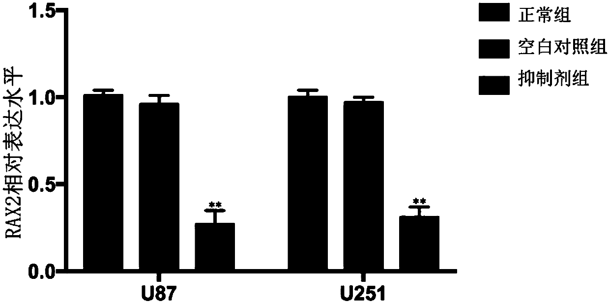 Targeting inhibitor of RAX2 (Retina and Anterior Neural Fold Homeobox 2) gene and purpose thereof