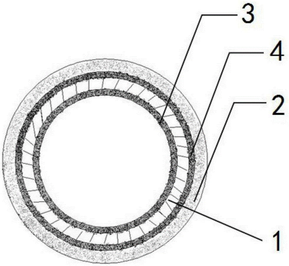 Multi-coating bio-degradable metal support and preparation method thereof