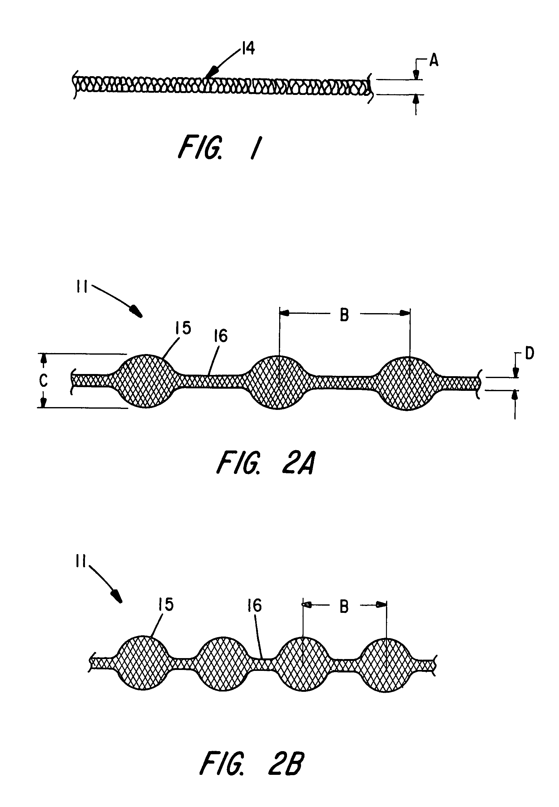 Braided occlusion device having repeating expanded volume segments separated by articulation segments