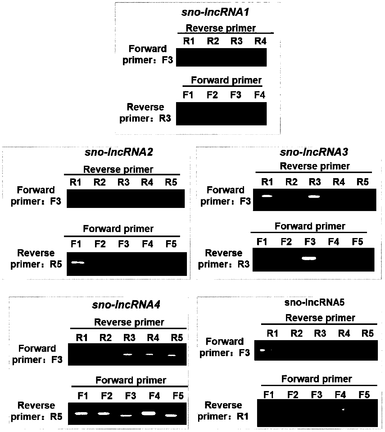 Prader-Willi Syndrome detection kit and use method thereof