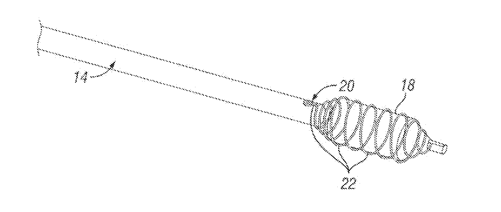 Angioplasty balloon having selectively deployable cutting or scoring element and related methods