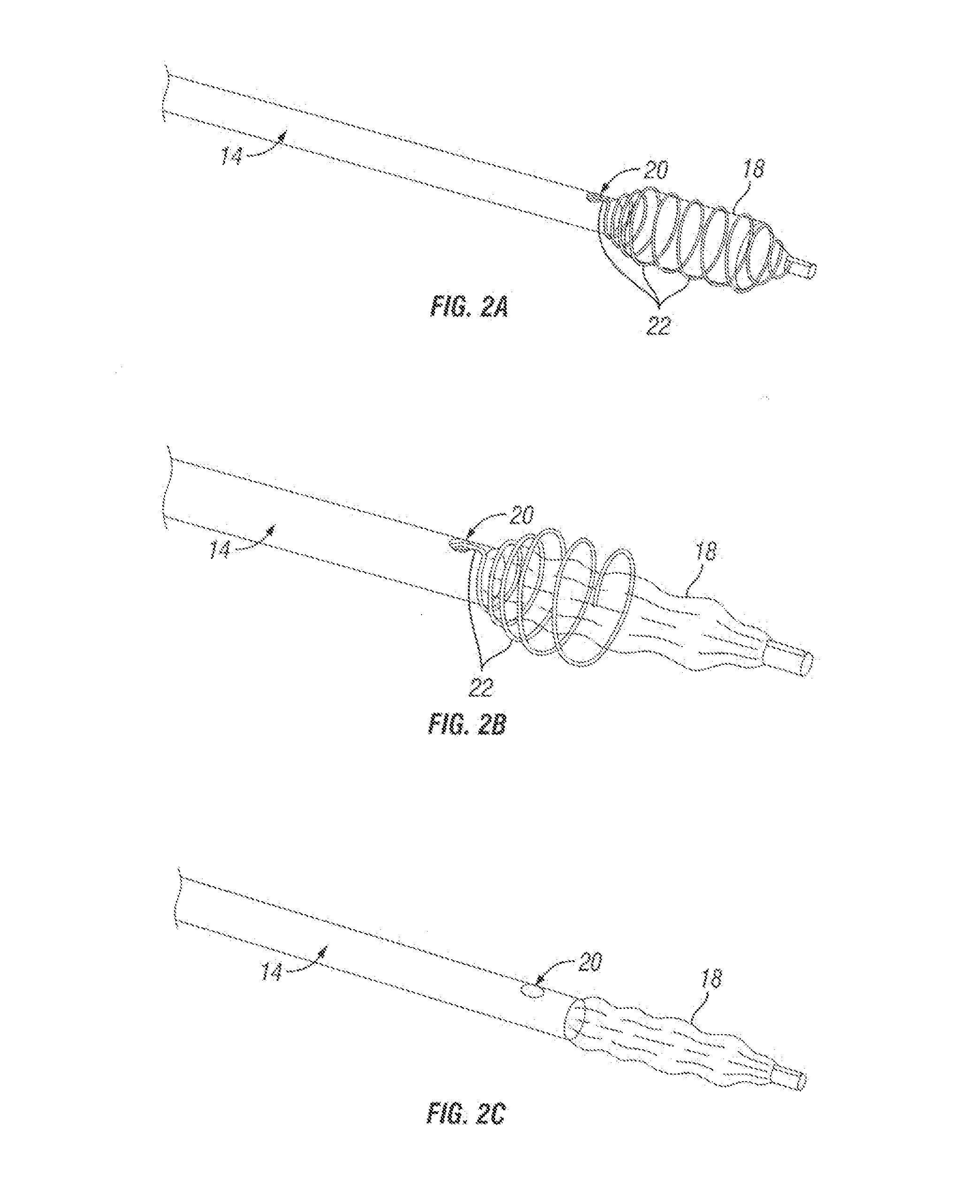 Angioplasty balloon having selectively deployable cutting or scoring element and related methods