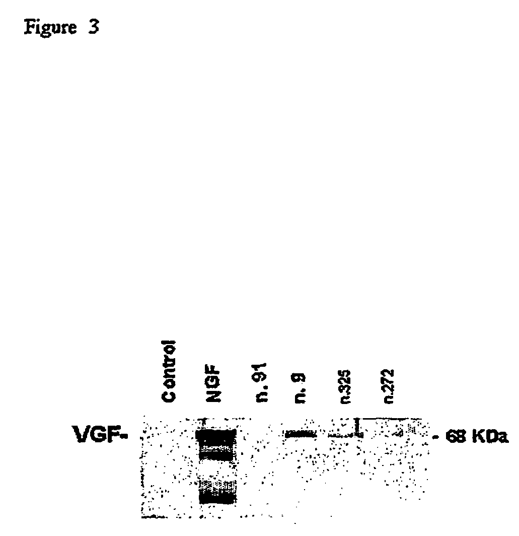 Pharmaceutical compositions for the treatment of diseases related to neurotrophines