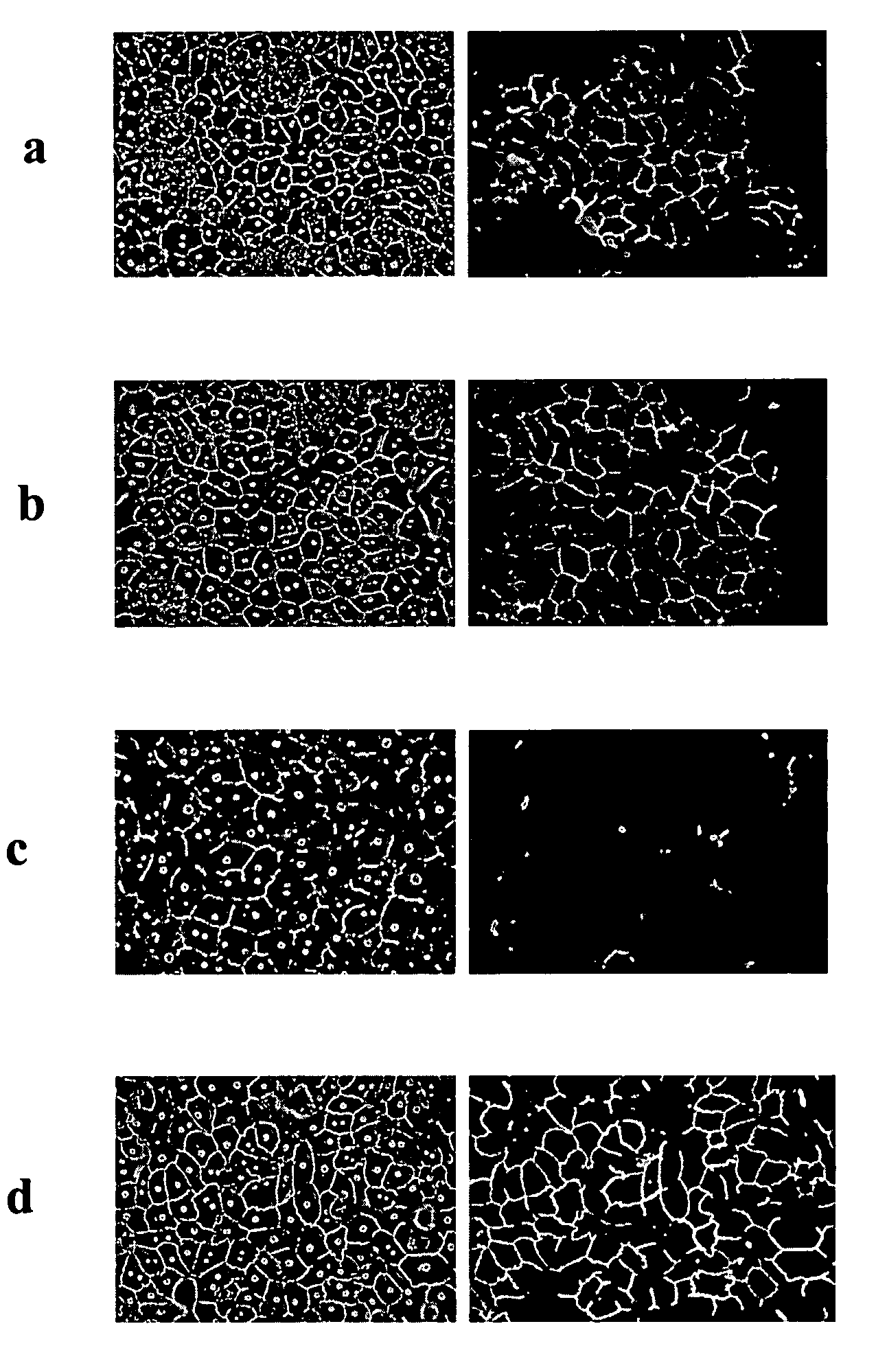 Method of screening candidate compounds for susceptibility to biliary excretion