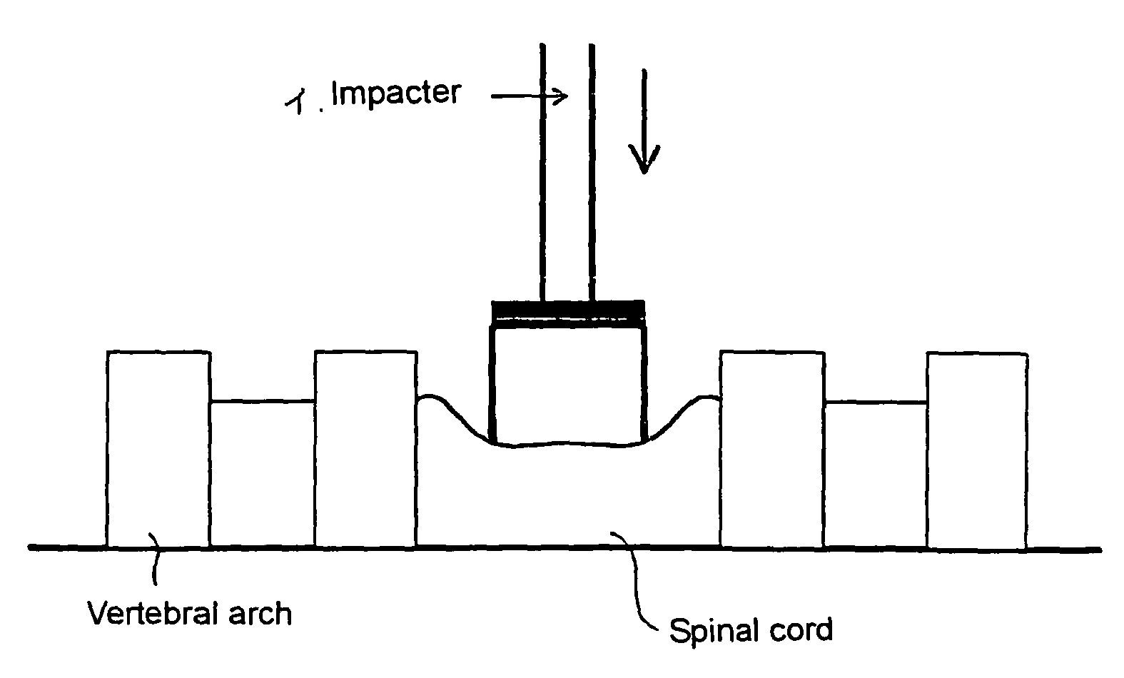 Method of constructing spinal injury model monkey and utilization thereof