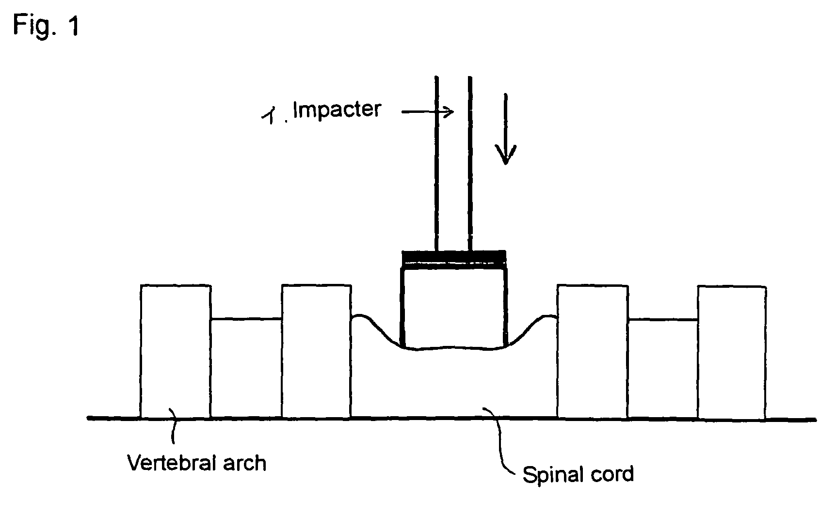 Method of constructing spinal injury model monkey and utilization thereof