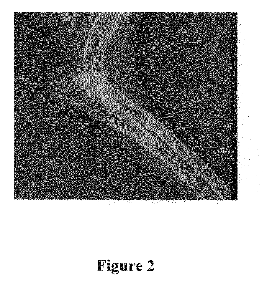 Compositions and methods for treatment of tumors by direct administration of a radioisotope