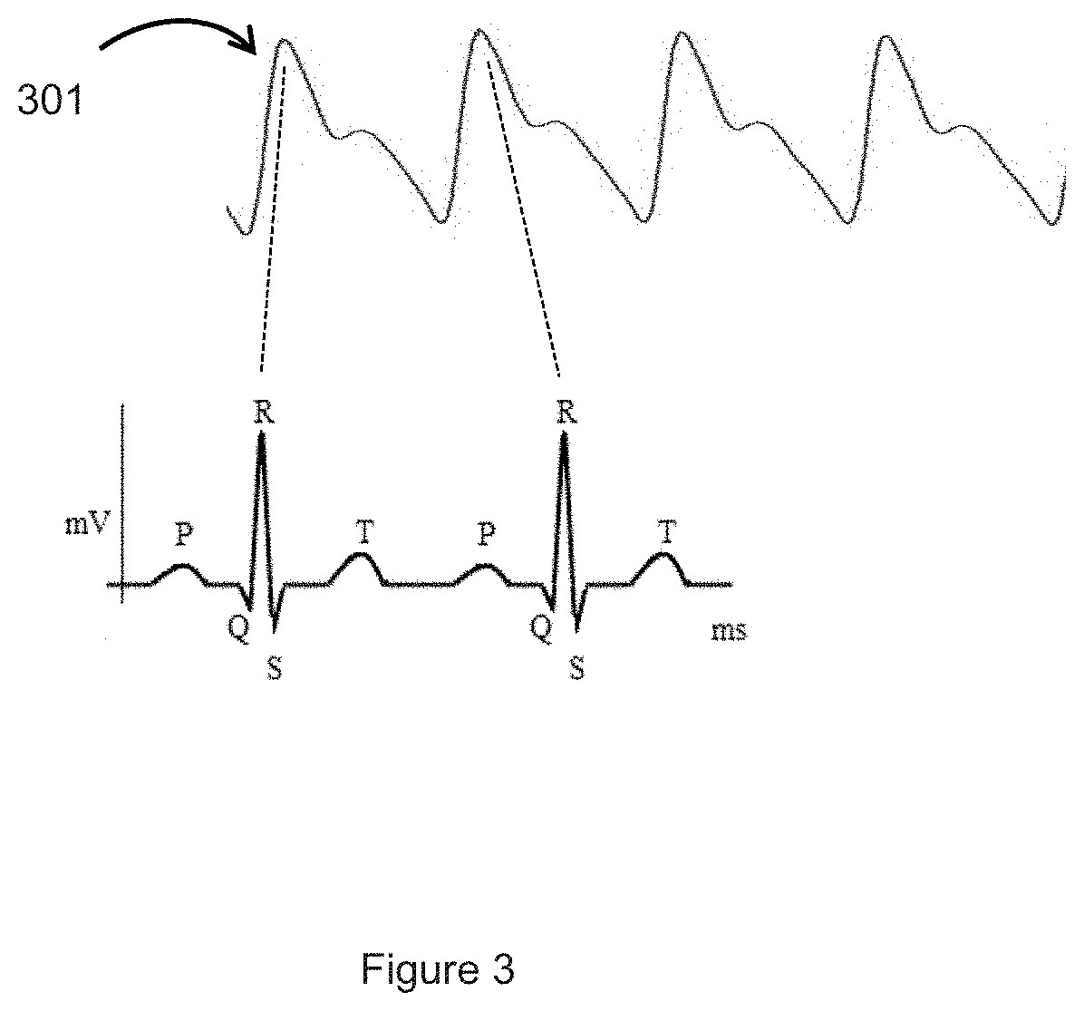 A method of selecting the intensity of a light source for monitoring an analyte in blood, and a device thereof