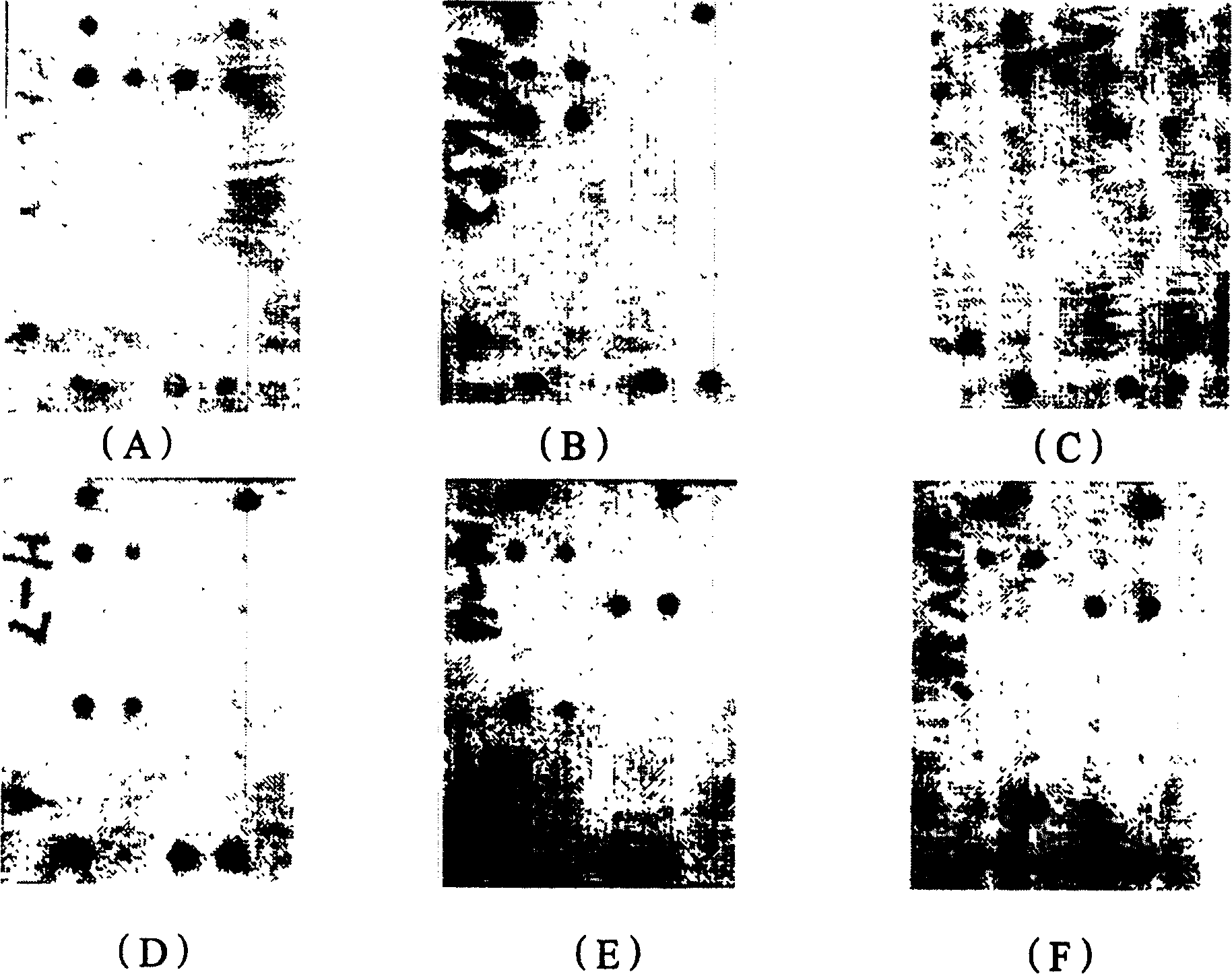 Diagnosis chip for testing subtype of human papilomavirus gene and preparation method and test method