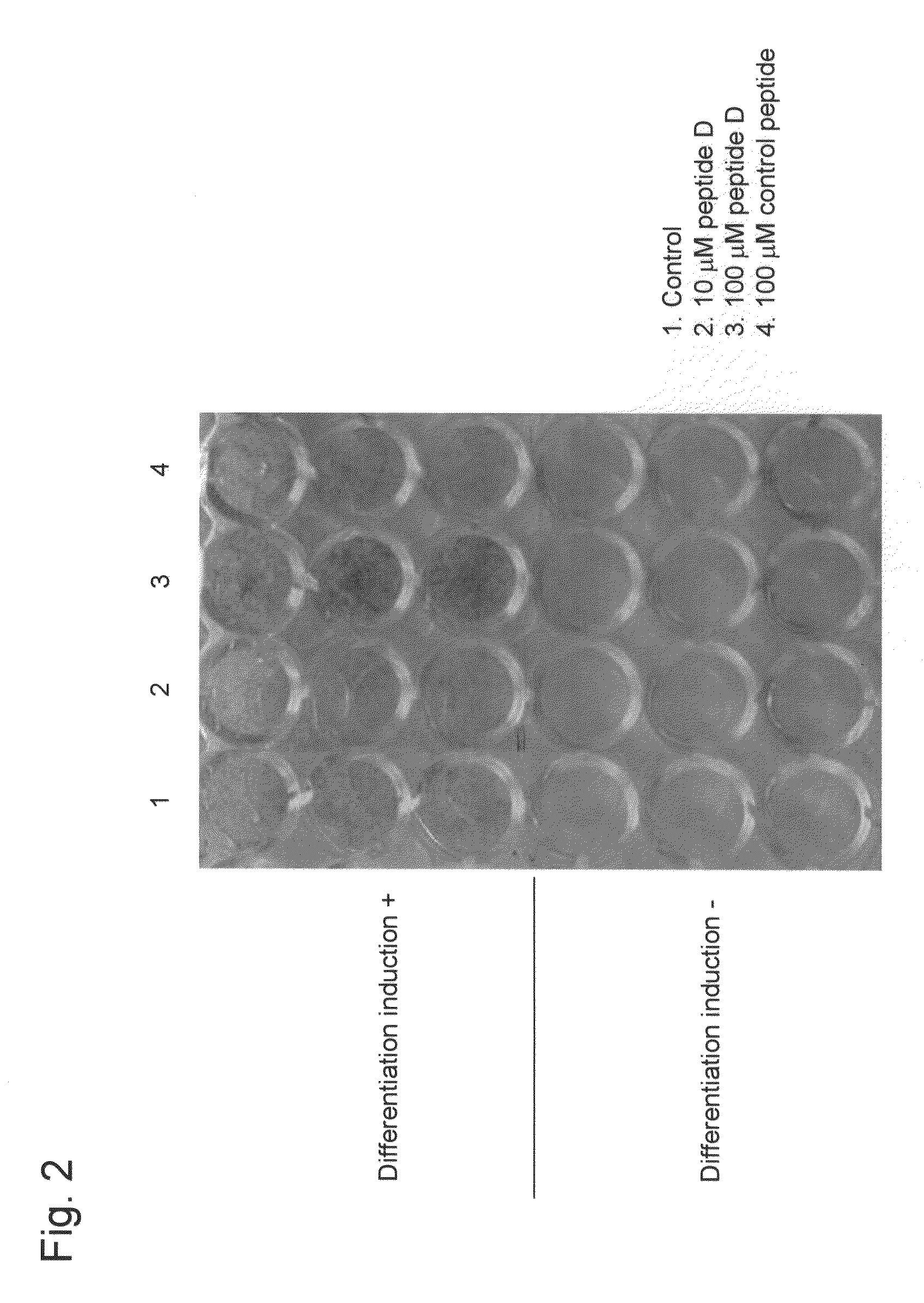 Novel bone mass increasing agent