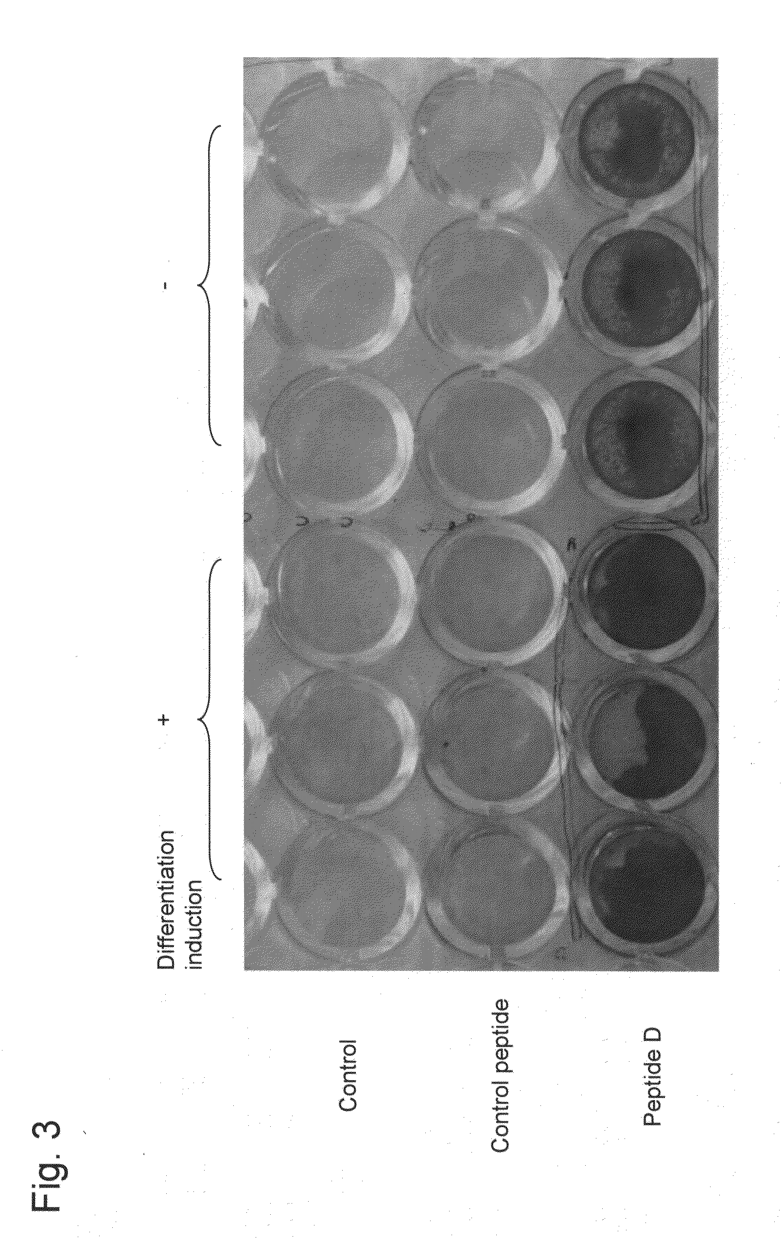 Novel bone mass increasing agent