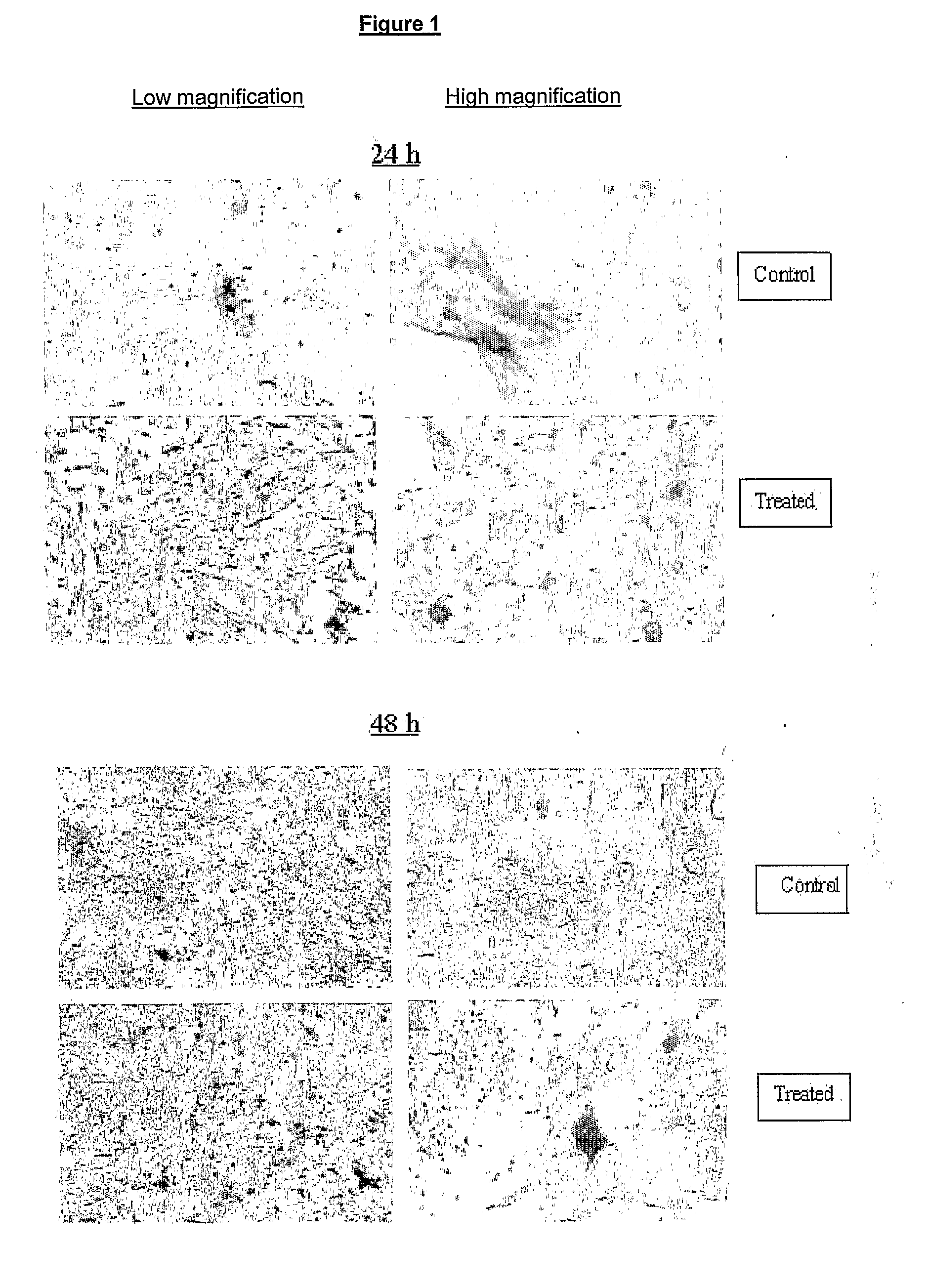 Pharmaceutical Composition for the Prevention/Treatment of Bone Disorders and a Process for the Preparation Thereof