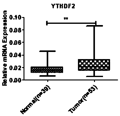 Application of YTHDF2 in diagnosis, prevention and treatment of urothelium carcinoma