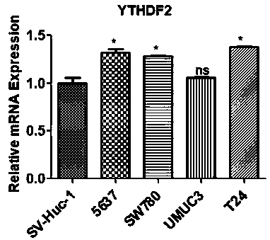 Application of YTHDF2 in diagnosis, prevention and treatment of urothelium carcinoma