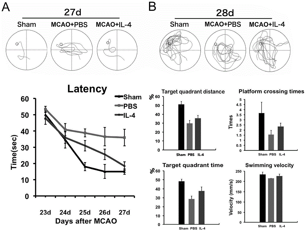 Application of interleukin-4 in preparation of medicine for promoting neural functional recovery after acute cerebral injuries