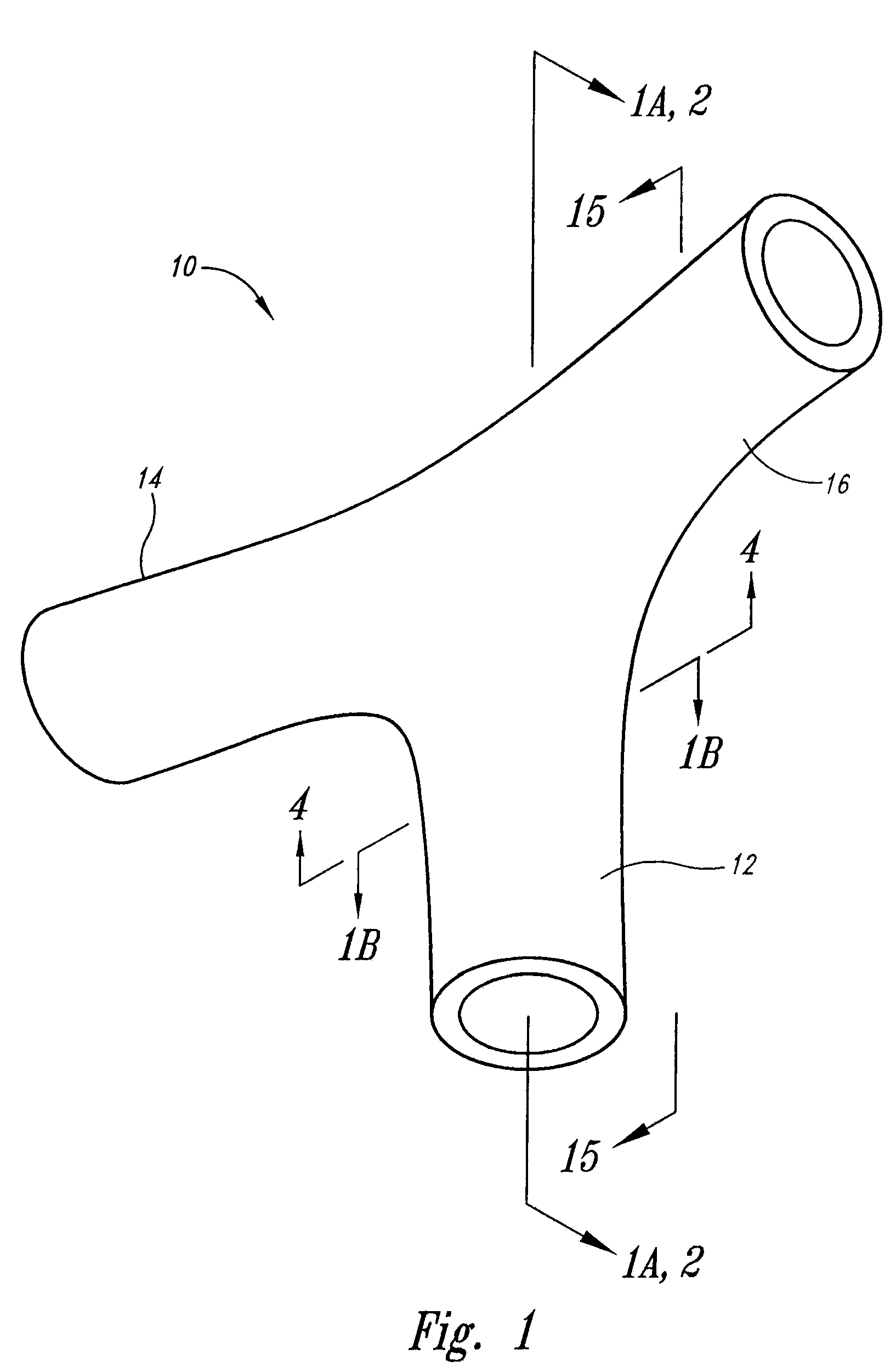 Vascular anchoring system and method