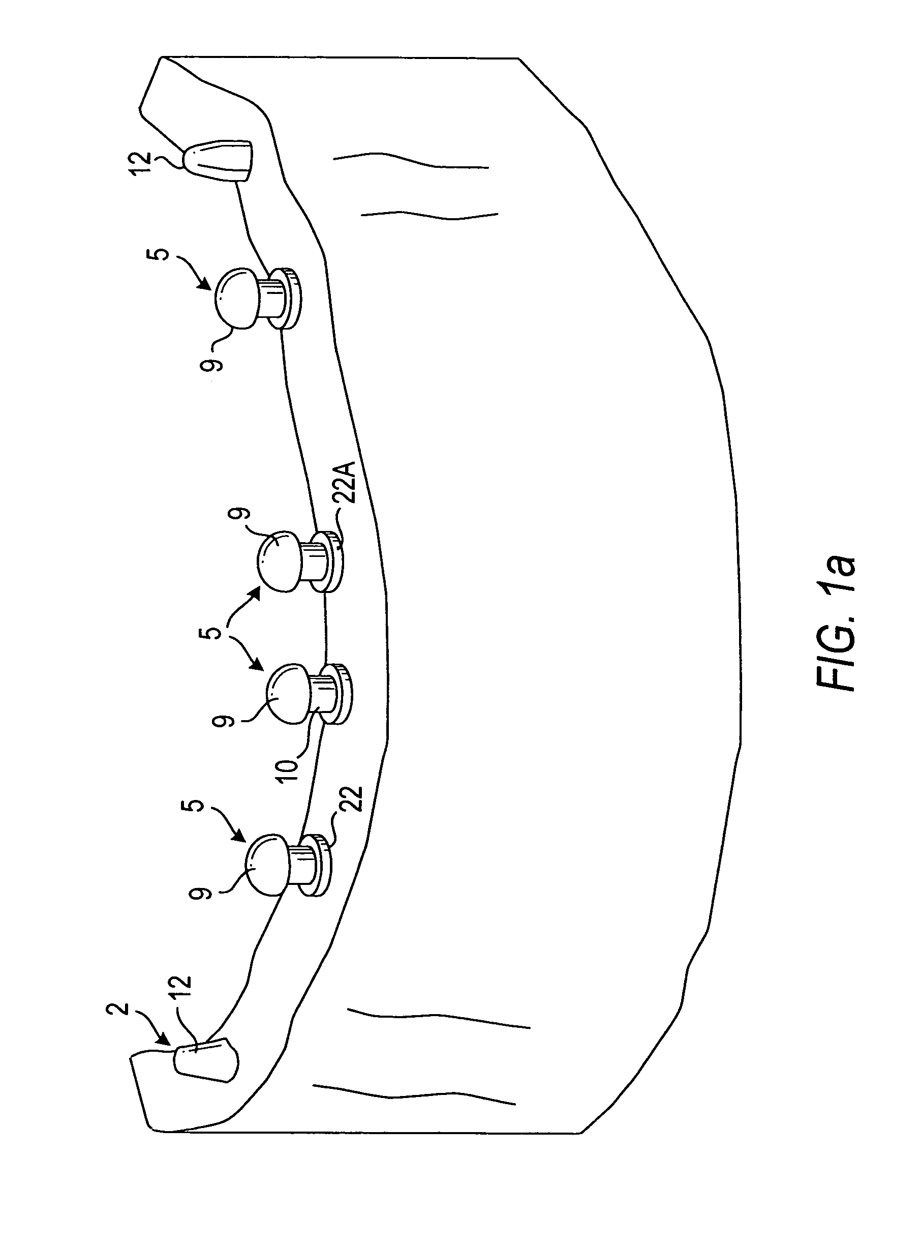 Components for permanent removable and adjustable dentures and bridges