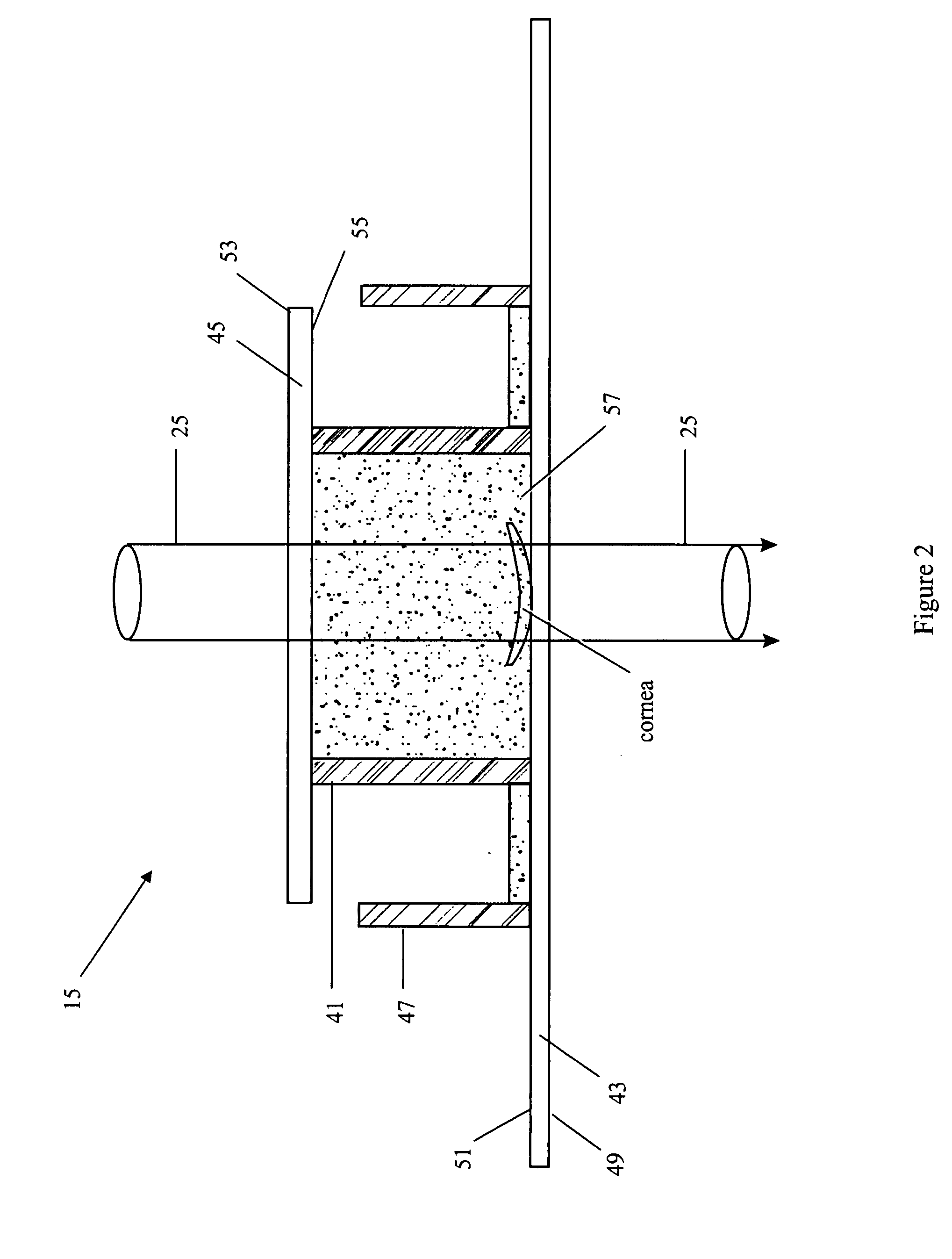 Wavefront characterization of corneas