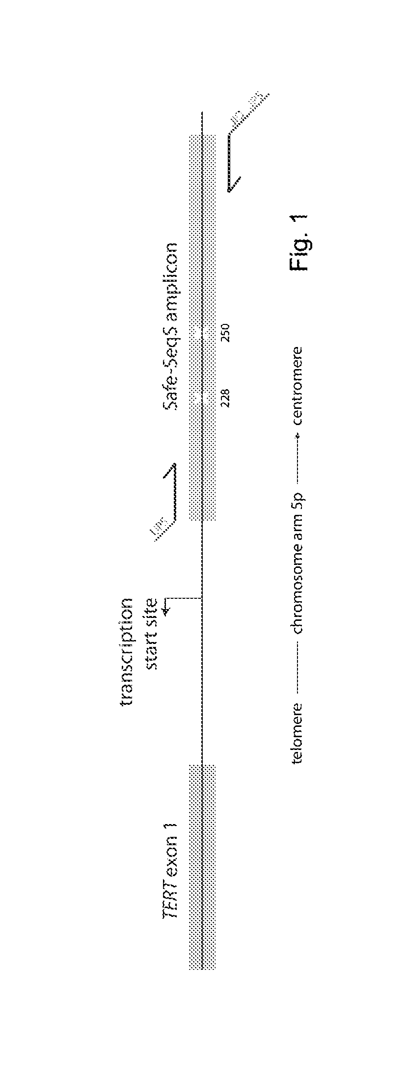 TERT Promoter Mutations in Urothelial Neoplasia