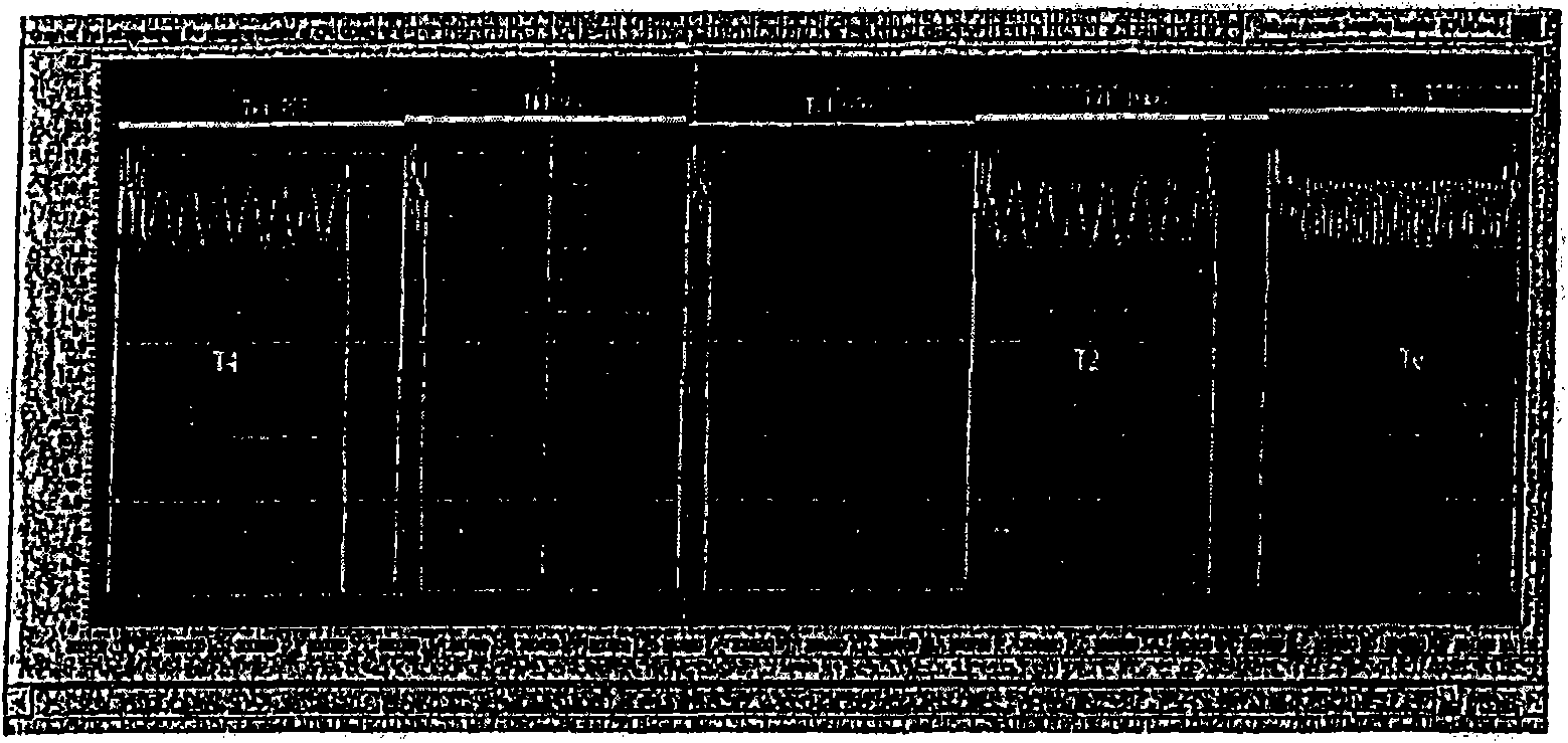 Monitoring device