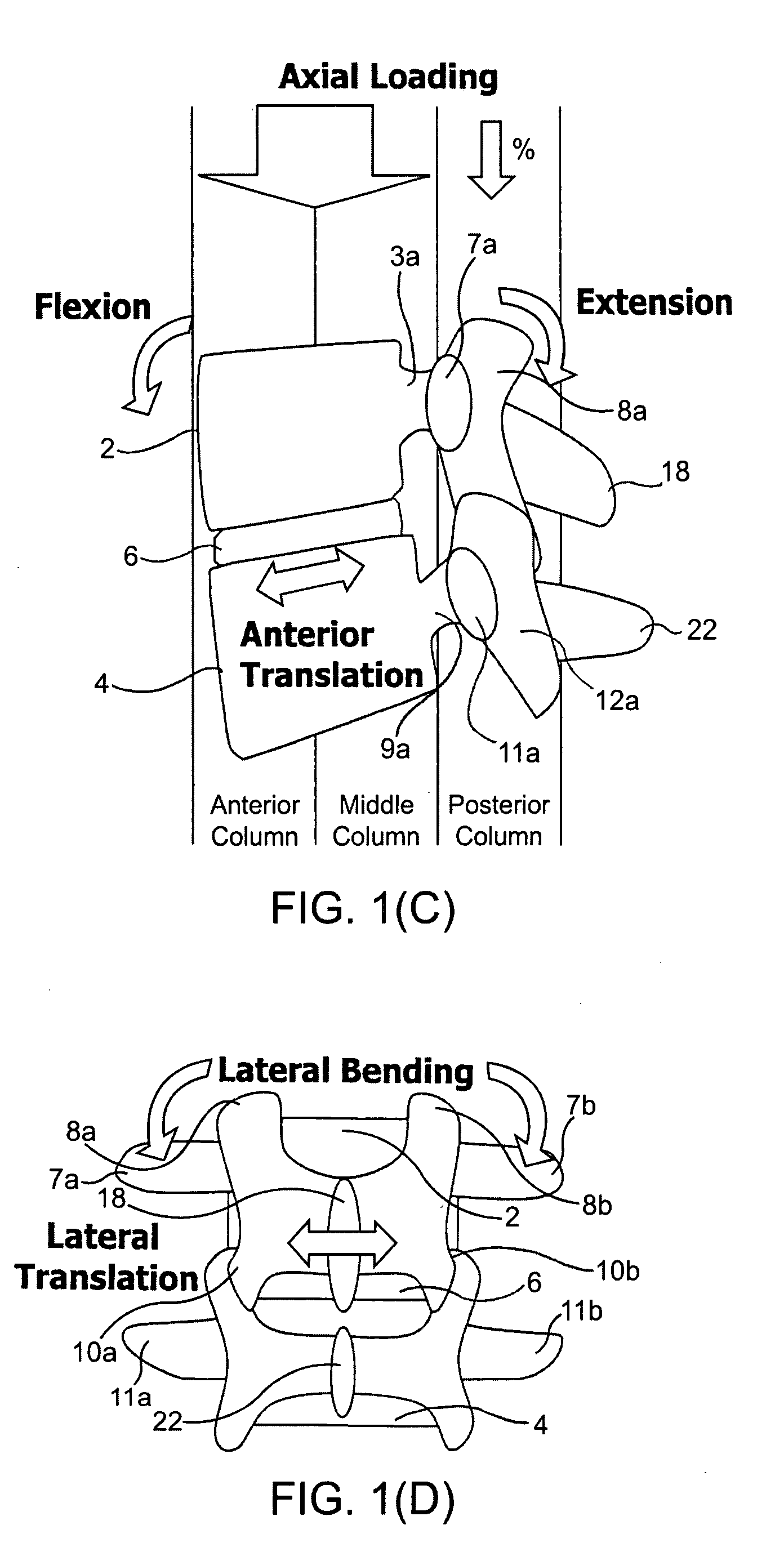 System and methods for posterior dynamic stabilization of the spine