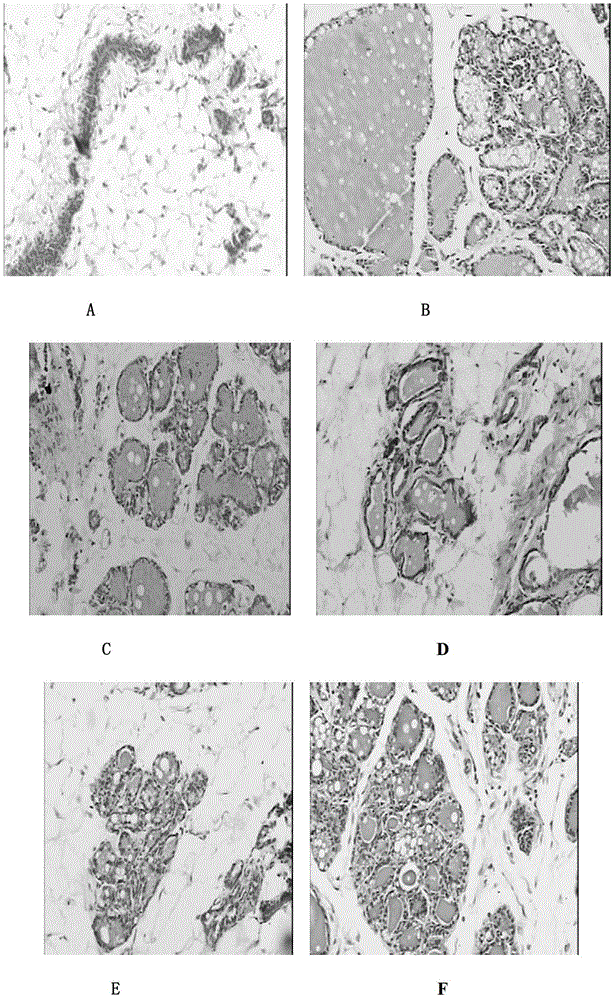 Breast nodule treatment medicine composition and preparation process and application thereof