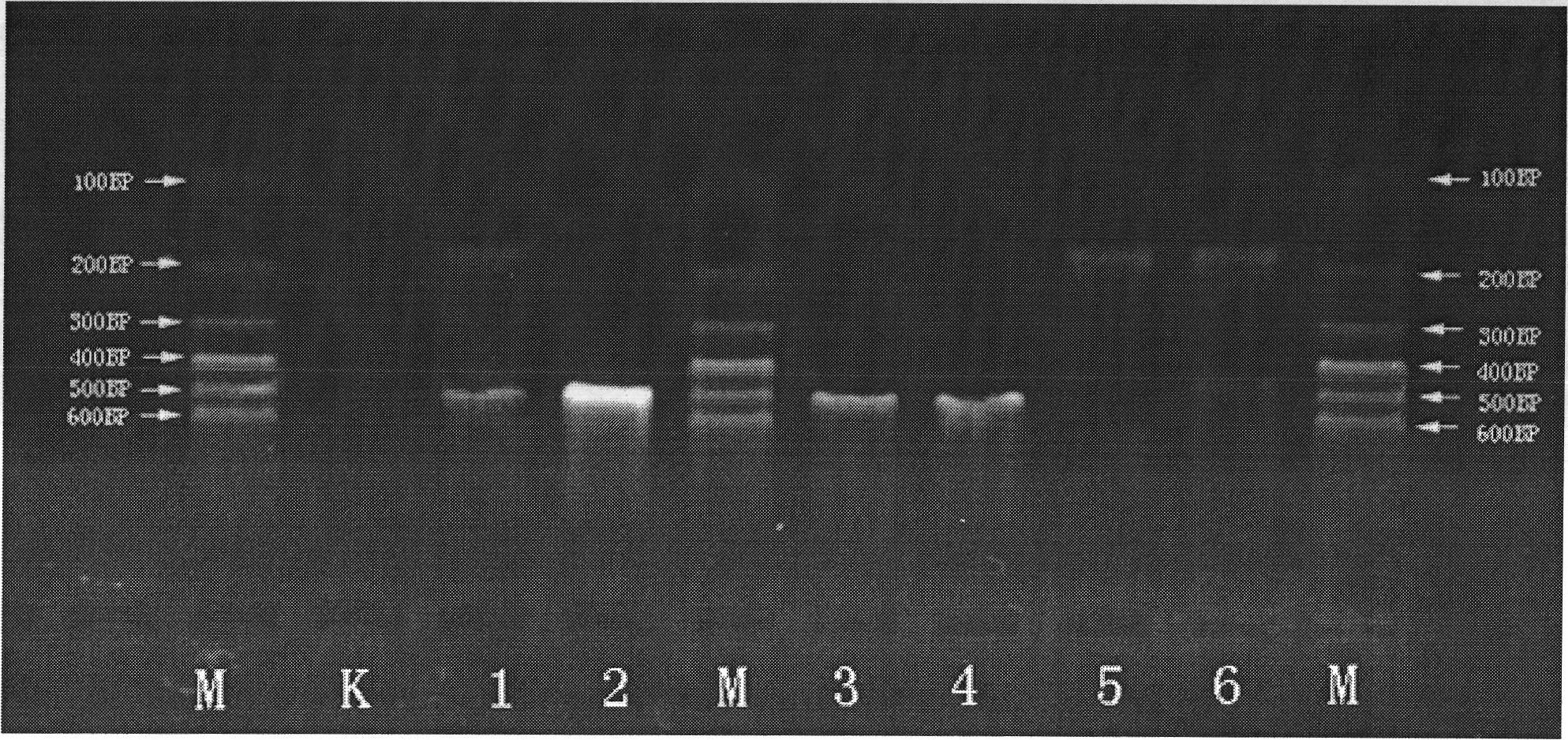 Multiple polymerase chain reaction (PCR) kit and method for detecting mosquito-borne pathogens