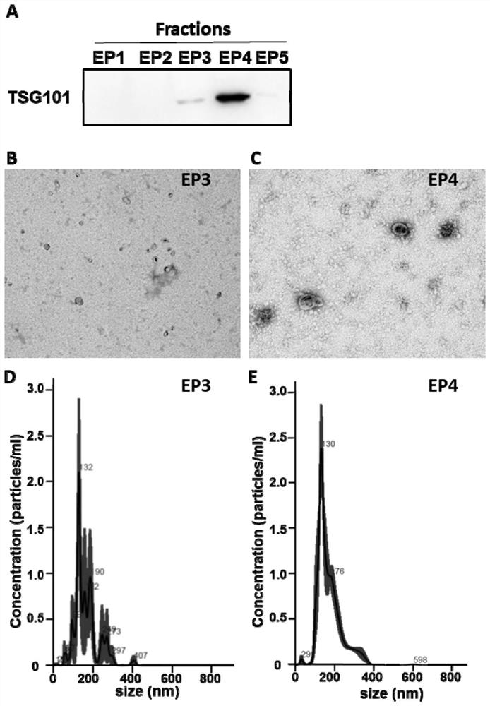 Exosome purification method