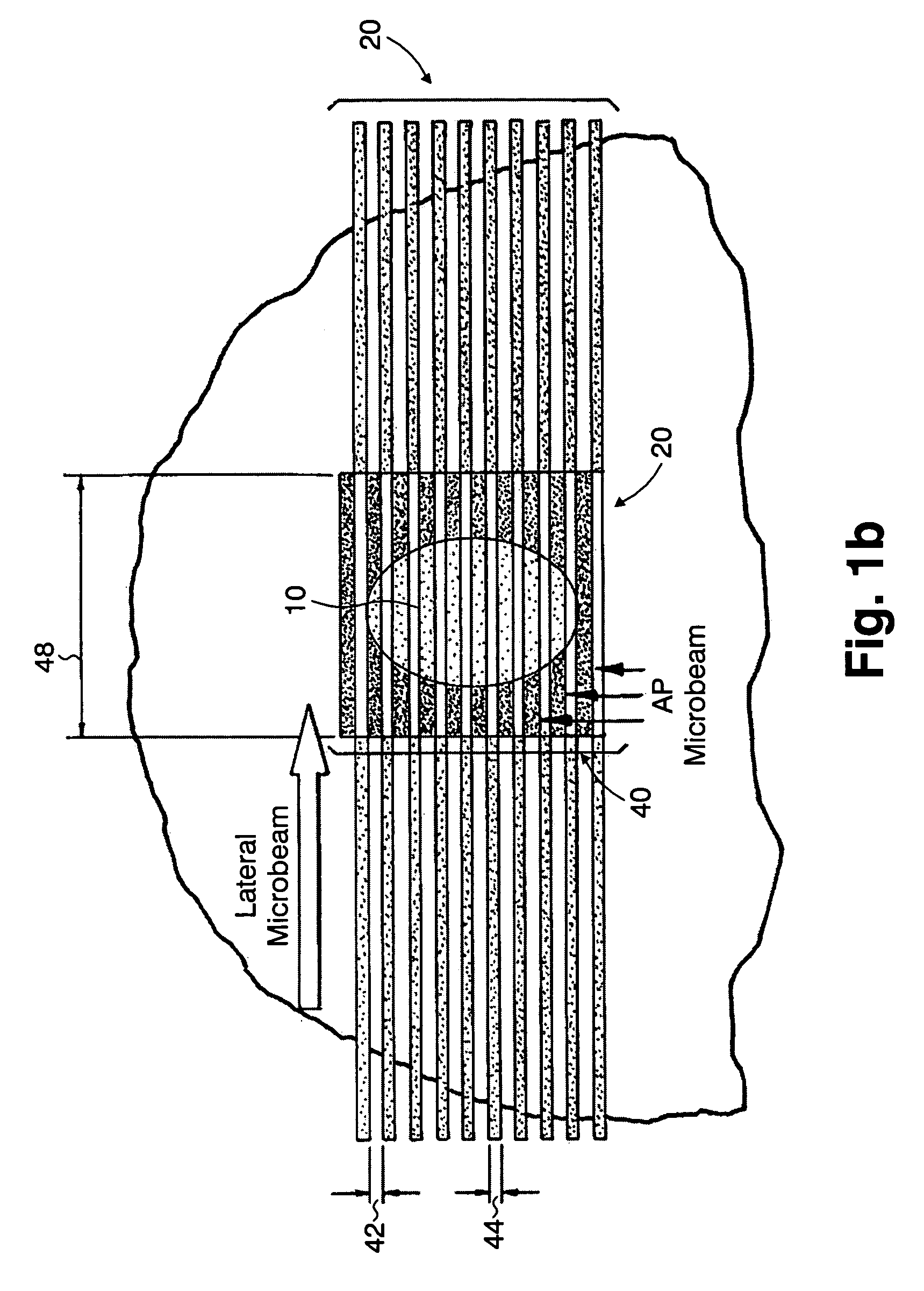 Methods for implementing microbeam radiation therapy