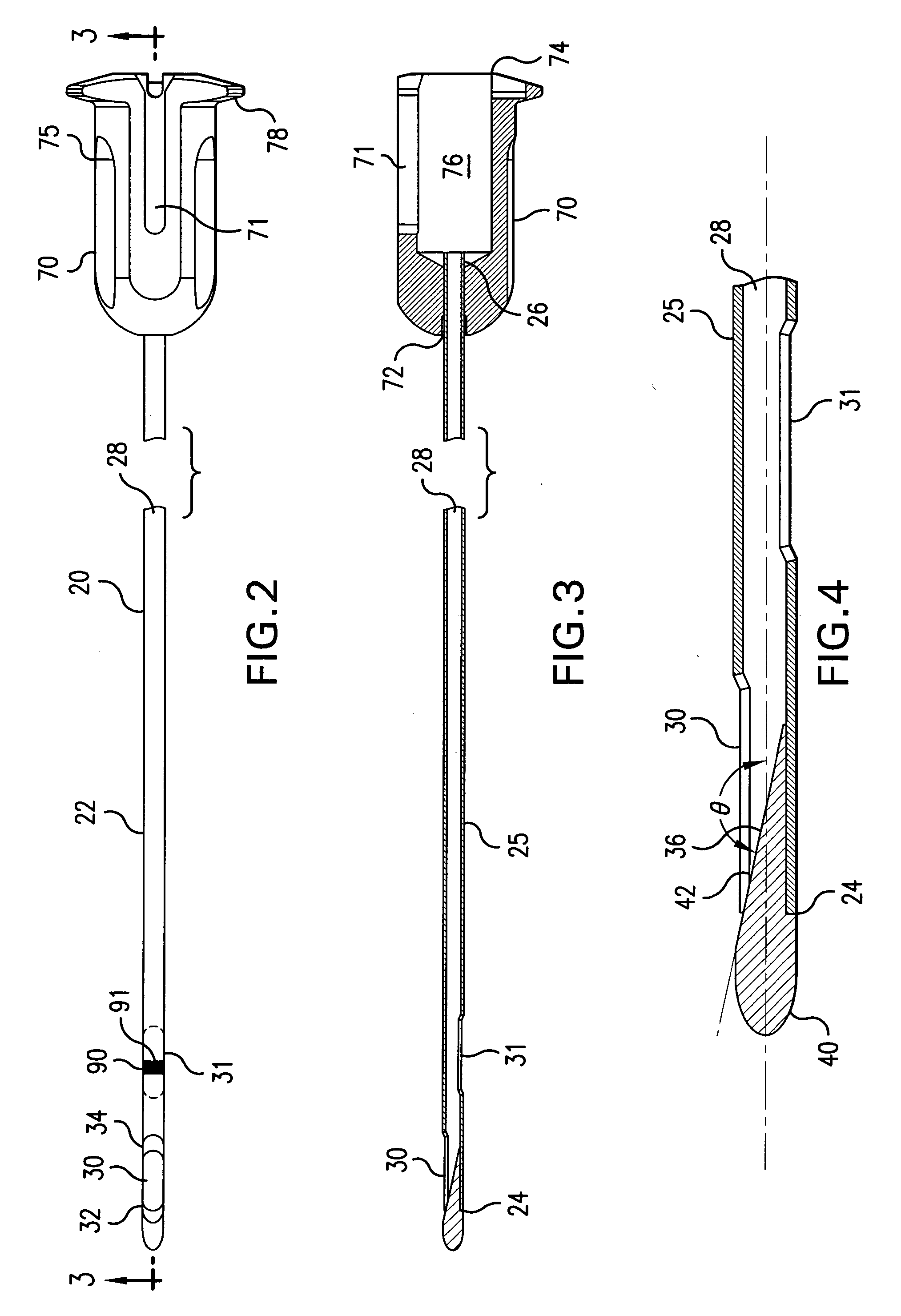 Implant positioning system and method