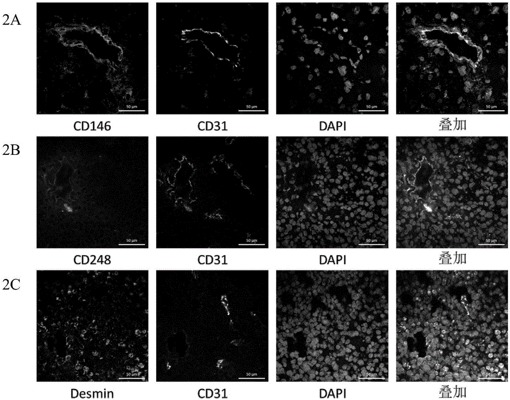 Application of CD146 monoclonal antibody in detection and separation and identification of glioma perivascular cells