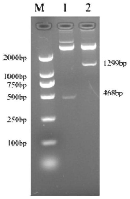 Construction method and application of recombinant adenovirus with triple epitope gene of cow mastitis pathogenic bacteria and c-type lysozyme gene of grouper