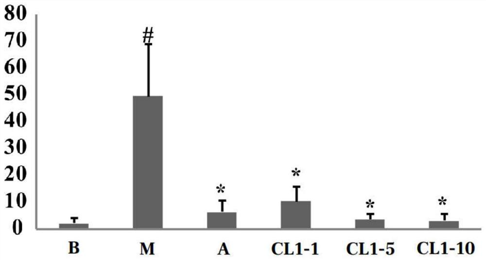 Application of roxburgh rose glycoside in preparation of anti-depression products