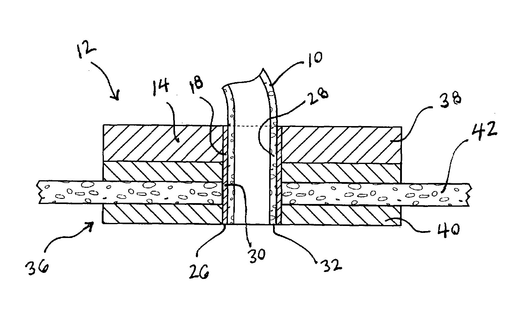 Components, systems and methods for forming anastomoses using magnetism or other coupling means