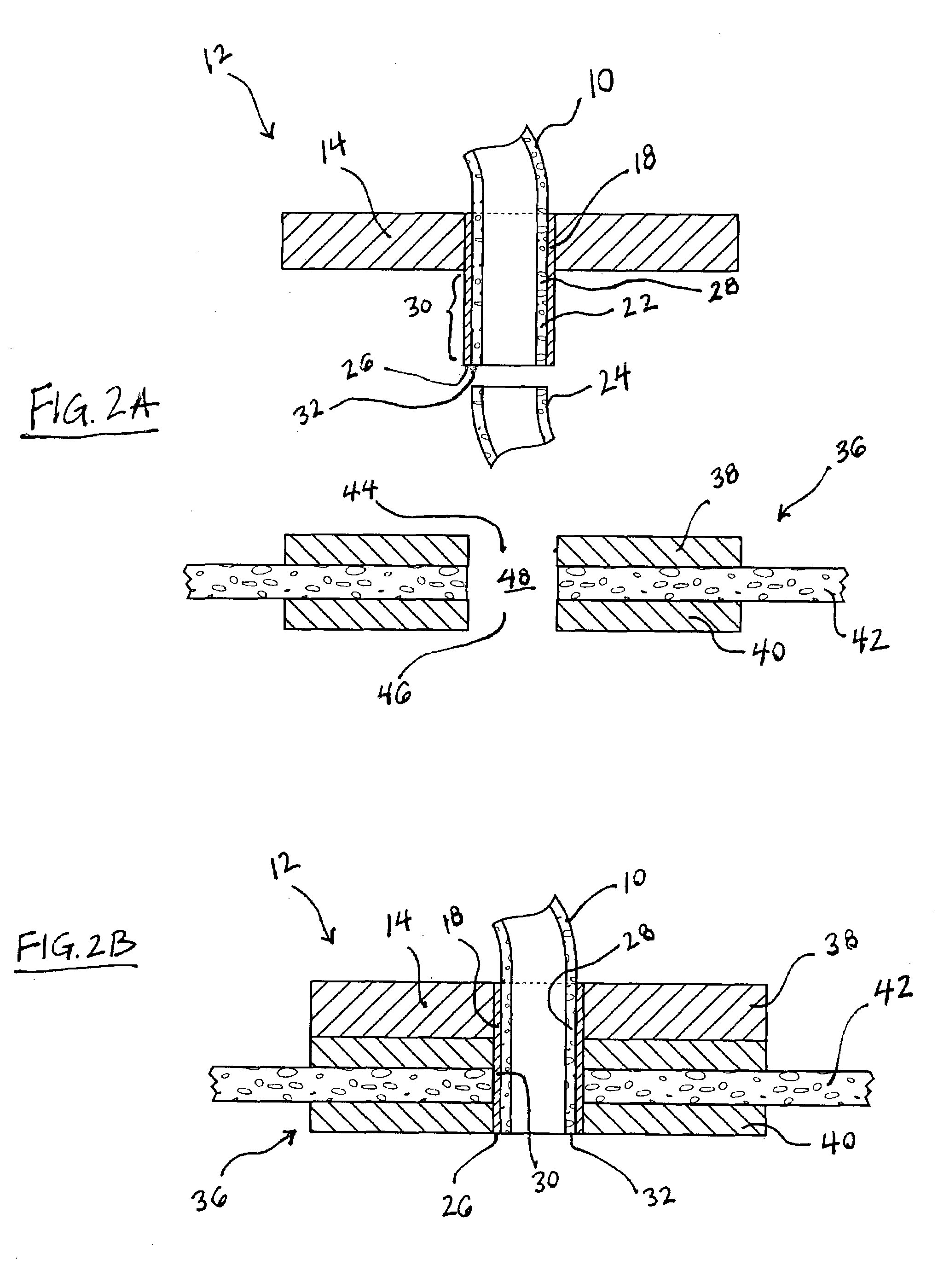 Components, systems and methods for forming anastomoses using magnetism or other coupling means