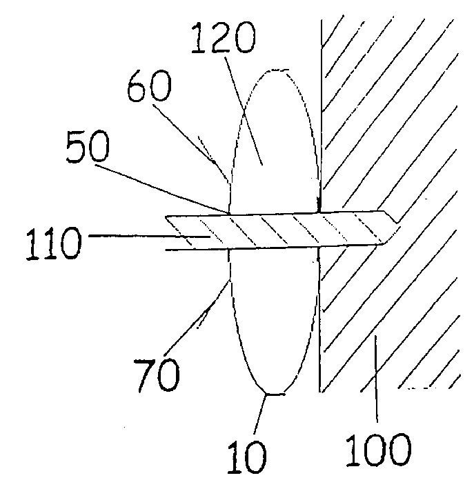 Debris collection device and method