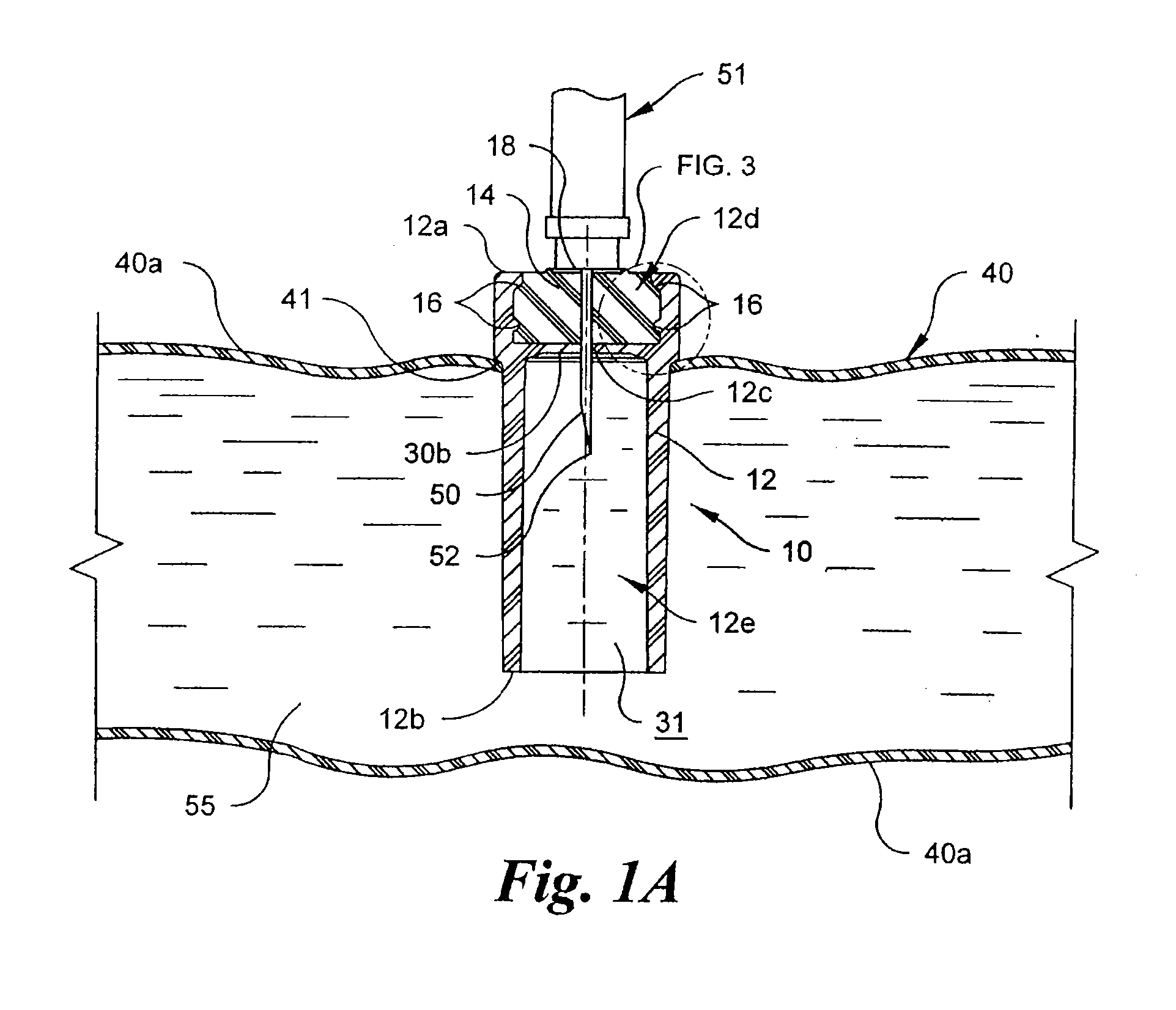 Injection Port and Method of Making the Same