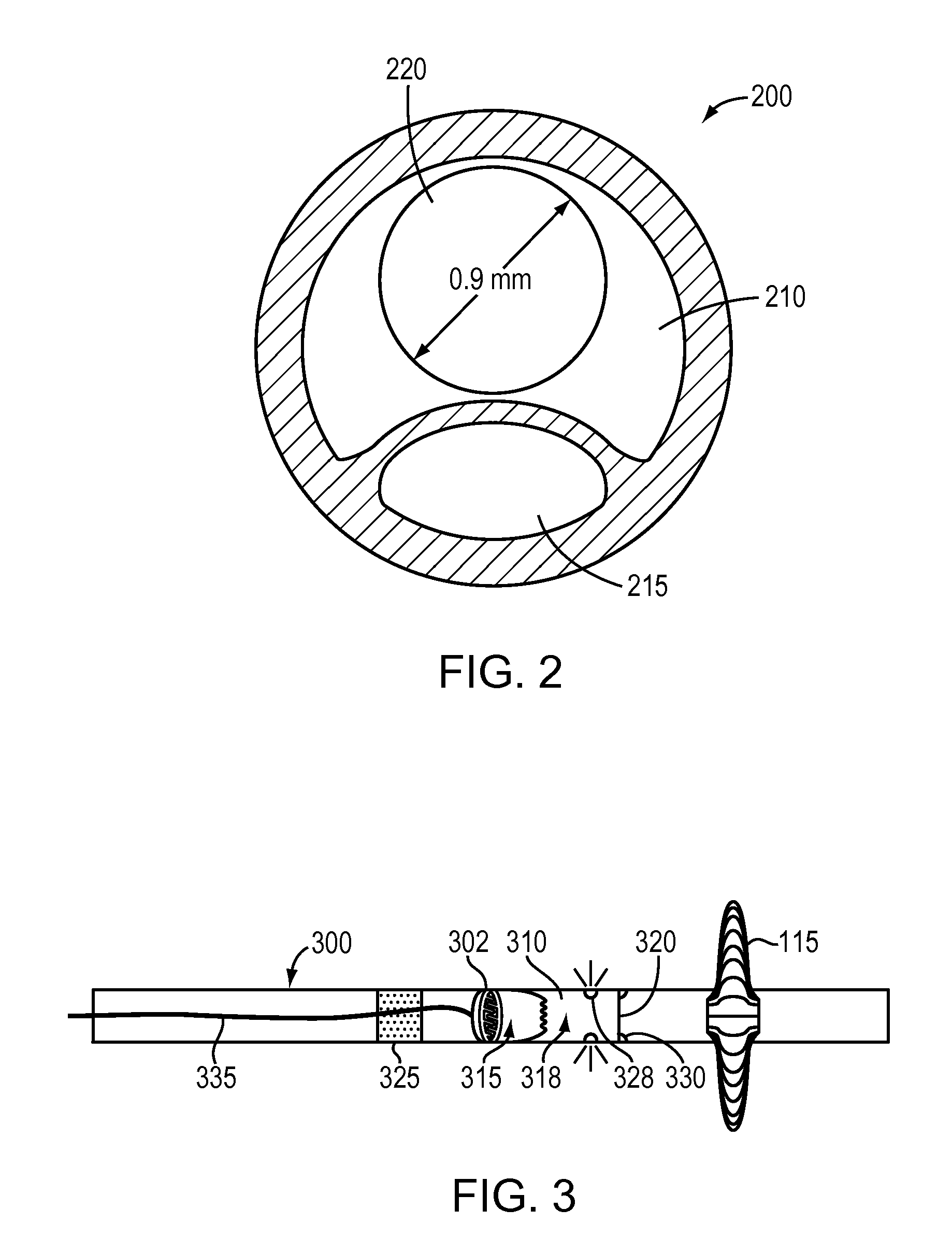 Catheter drug pump