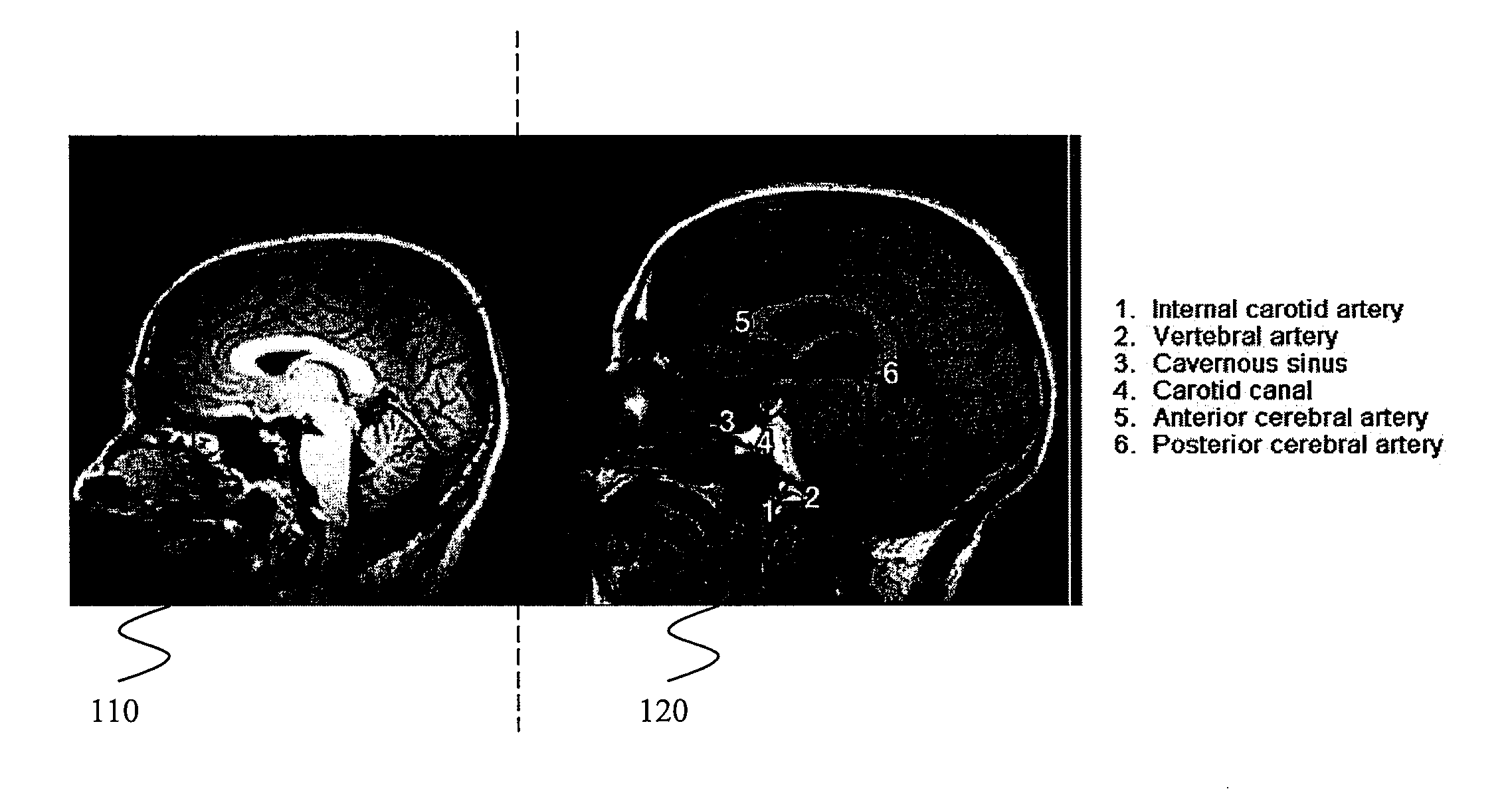 Systems and methods for synchronized image viewing with an image atlas