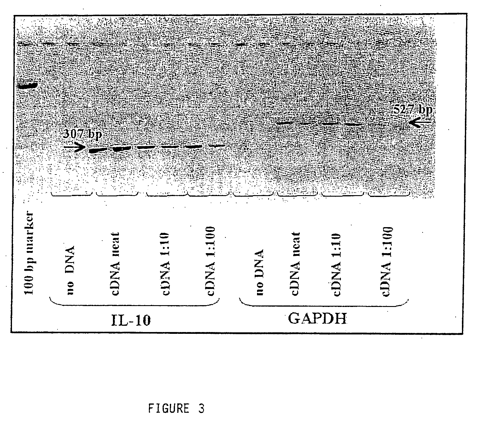 Corneal cells expressing active agents and methods of use thereof