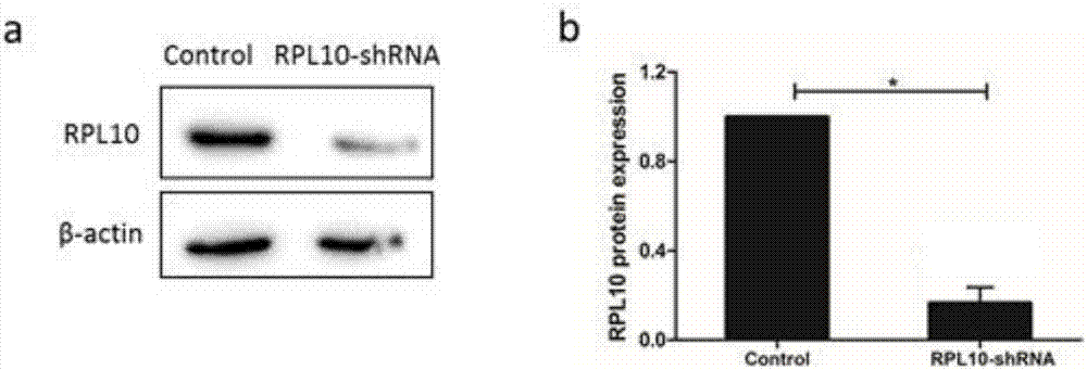 Application of RPL10 inhibitor in preparation of medicine for treating ovarian cancer