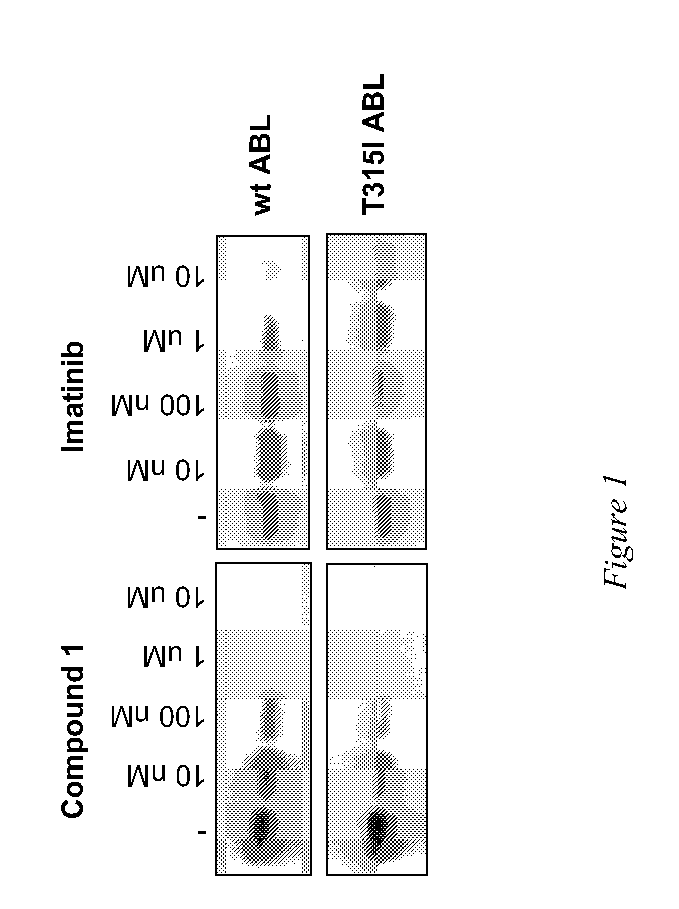 Use of a Kinase Inhibitor for the Treatment of Particular Resistant Tumors